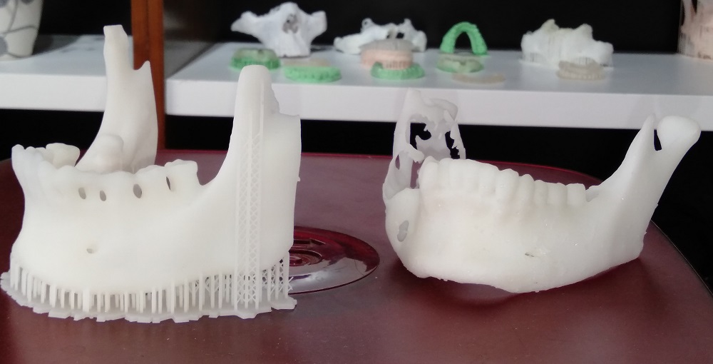 Mô hình xương hàm 3D